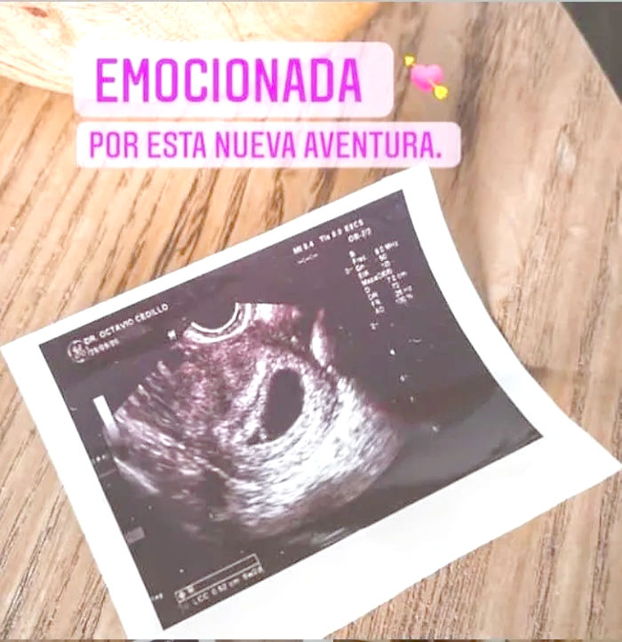 Paulina Goto announces with a photo that she is “pregnant” – Dimensión Real de Colima